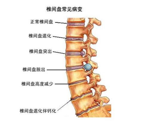 供需图片